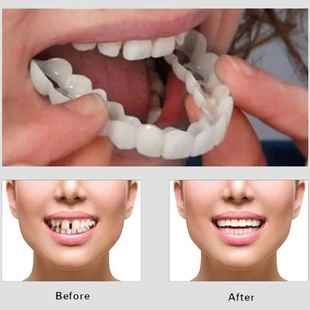 Snap On Smile - Snap On Smile